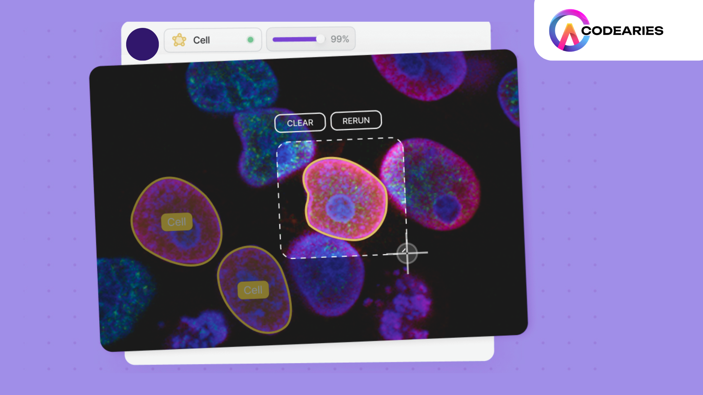 AI in Digital Pathology: Enhancing Cancer Diagnosis